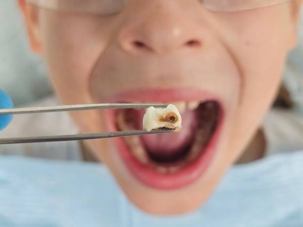 Best Emergency TMJ Treatment in Bacliff, TX